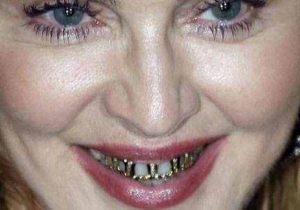 Madonna and her grill http://www.dailymail.co.uk/tvshowbiz/article-2561717/Madonnas-eight-year-old-son-David-gets-gold-grills-just.html